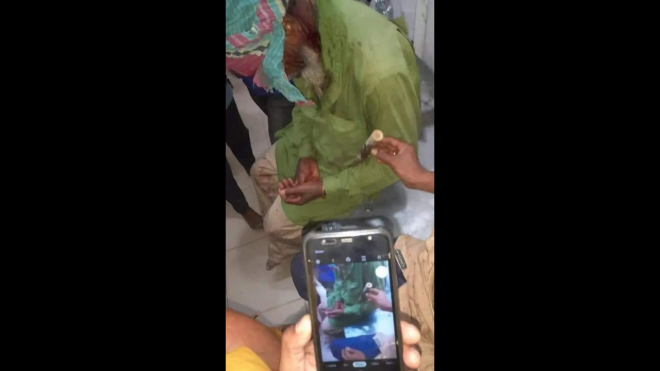 অটোরিকশা ভাড়া নিয়ে বিরোধ থেকে সংঘর্ষ, টেঁটাবিদ্ধ, যুবক সহ প্রায় অর্ধশত।