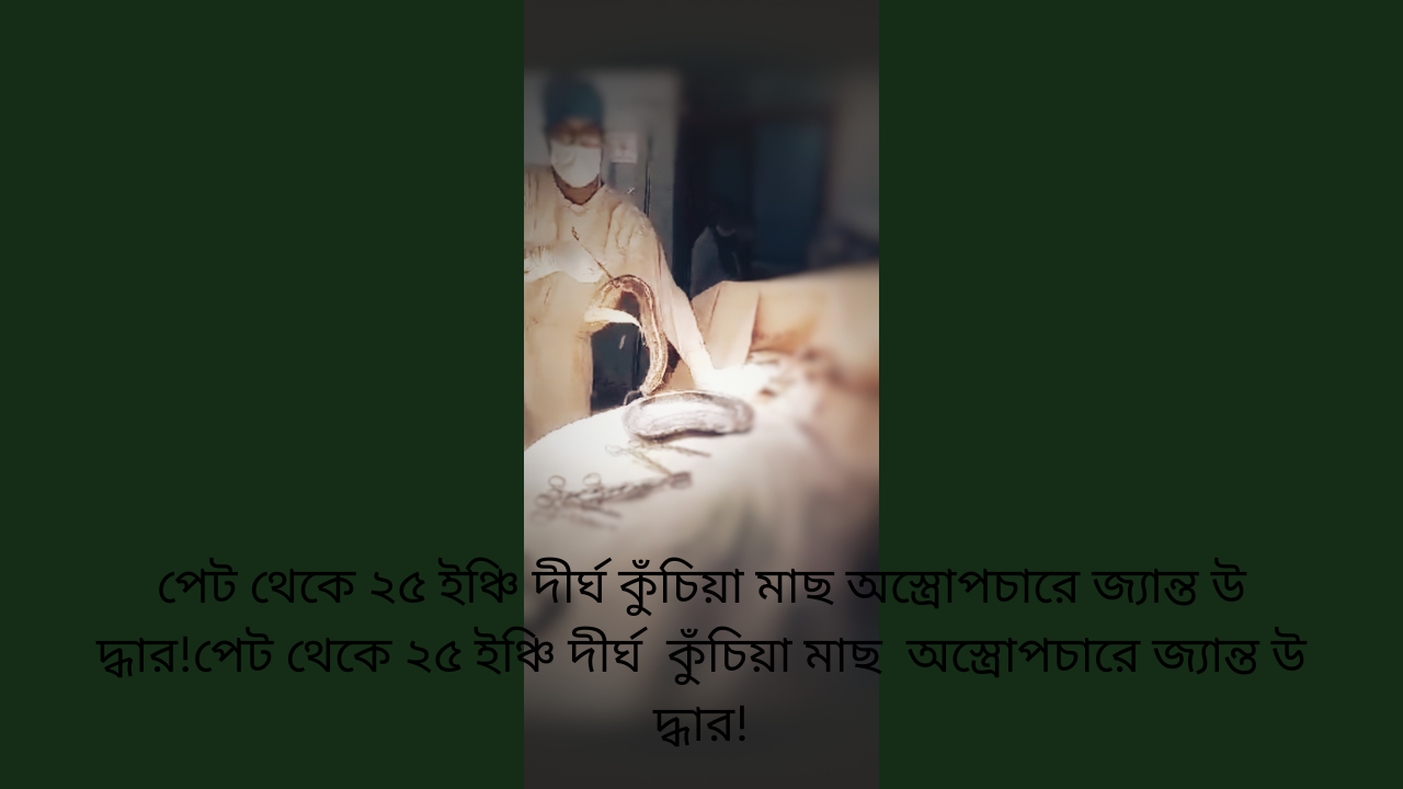 প্রথম পাতা » প্রধান সংবাদ » পেট থেকে ২৫ ইঞ্চি দীর্ঘ কুঁচিয়া মাছ অস্ত্রোপচারে জ্যান্ত উ দ্ধার!